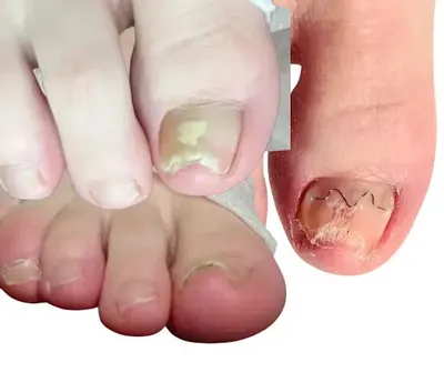 Centrum zdrowej stopy usługi i szkolenia Monika Ginter