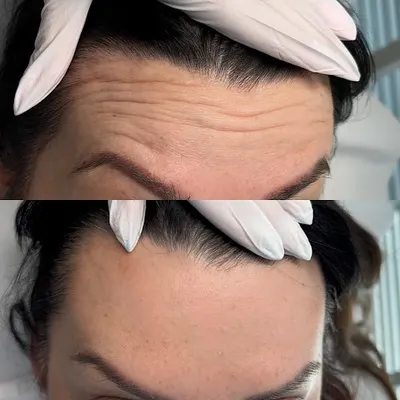 Medycyna Estetyczna- Julia Prokopiuk